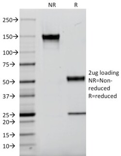 Kappa Light Chain Antibody (L1C1), Novus Biologicals 0.2mg; Unlabeled:Antibodies,